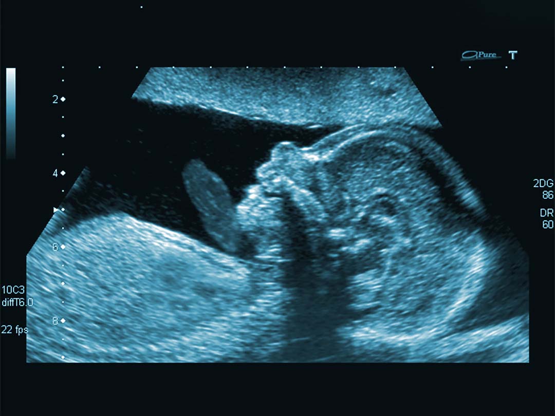 Fetus_blue_color_scale_4-3_1080x810