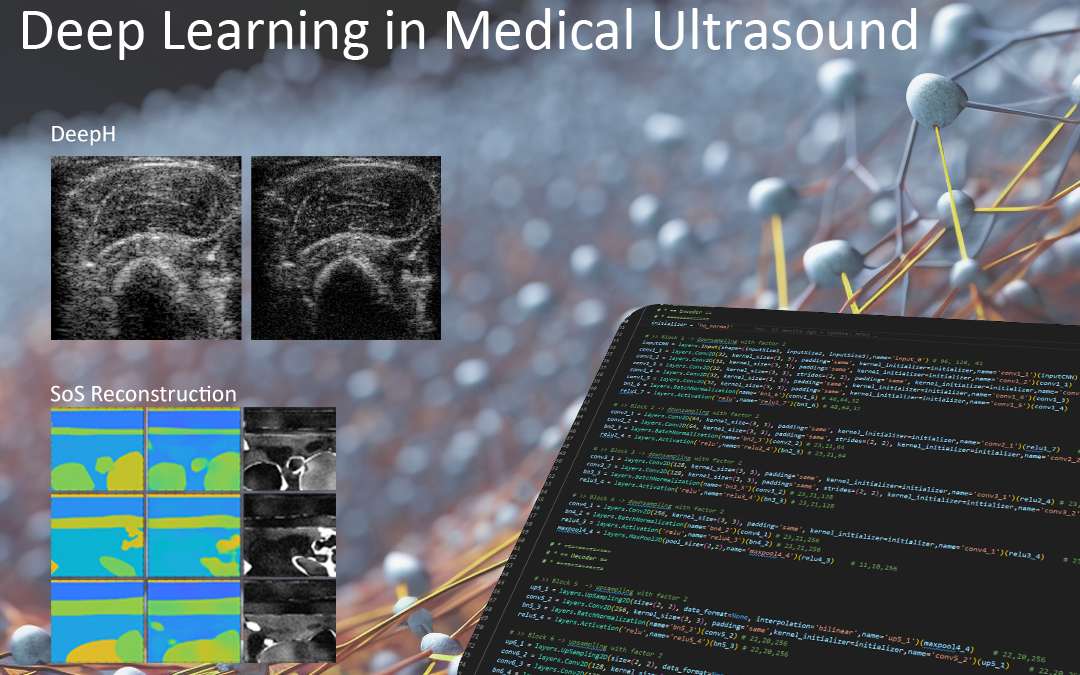 Deep Learning im medizinischen Ultraschall