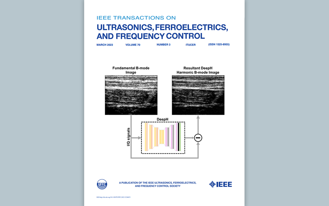 DeepH for fast harmonic US imaging is front cover of IEEE TUFFC