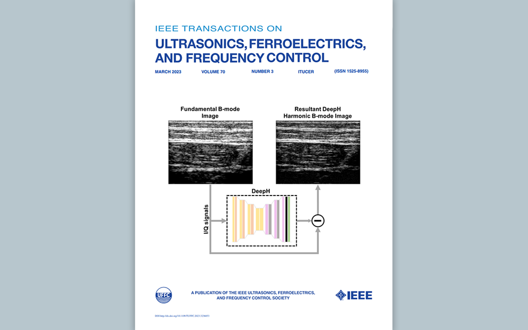 DeepH als neue harmonische US-Bildgebungsmethode ist auf der Frontseite der IEEE TUFFC